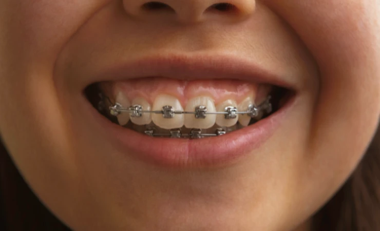 hur behandlas korsbett-steg for steg