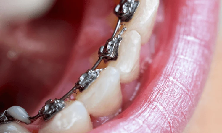 Ortodontiassistenter på Göta Dental