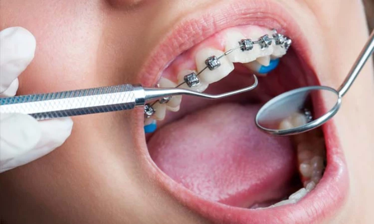 korsbett behandling pris och resultat