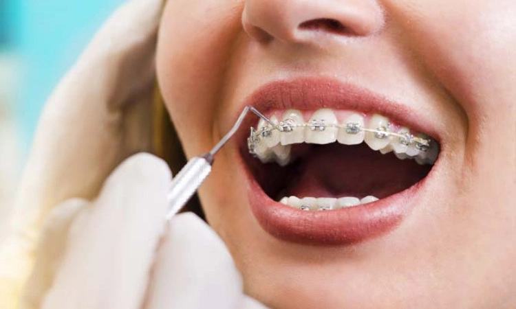 modern och smartfri behandling av underbett