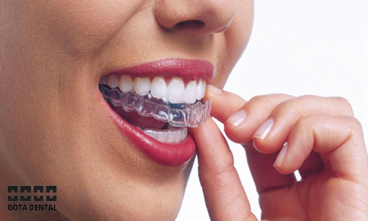 nvisalign vs traditionell tandstallning