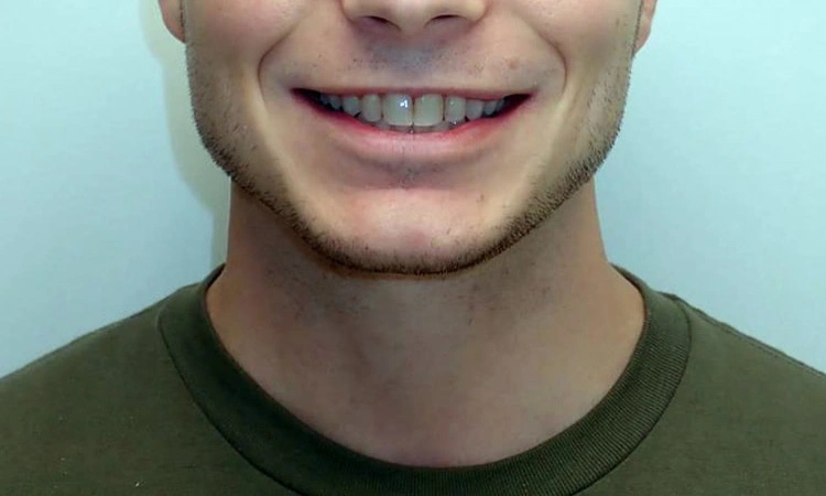 ortodontisk behandling