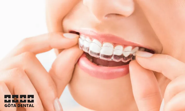 Är osynlig tandställning bra_