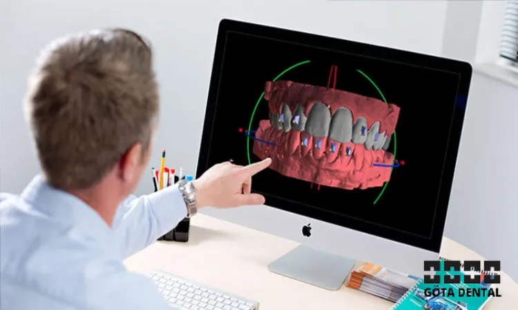 aligner behandling för vuxna steg för steg