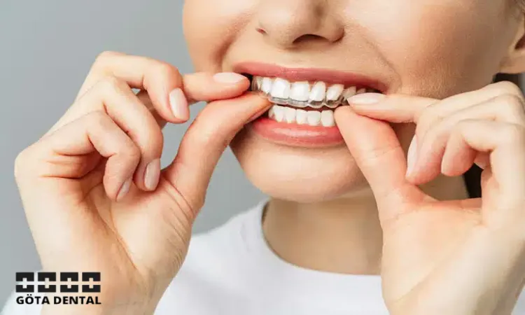 invisalign nackdelar