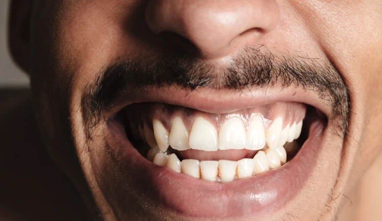 Tandreglering för barn i Göteborg